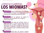 Como se clasifican los MIOMAS en Querétaro (Municipio)