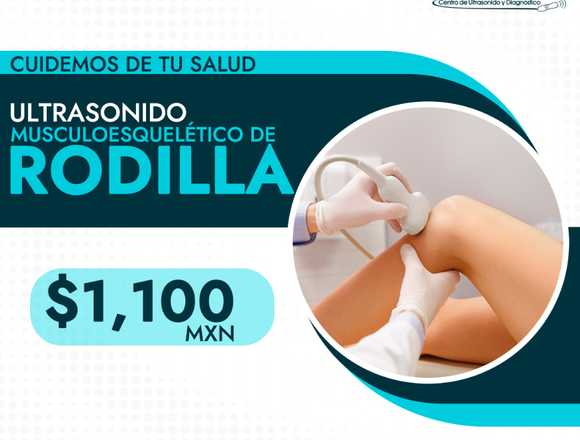 ¡Ultrasonido Musculo Esqueletico!