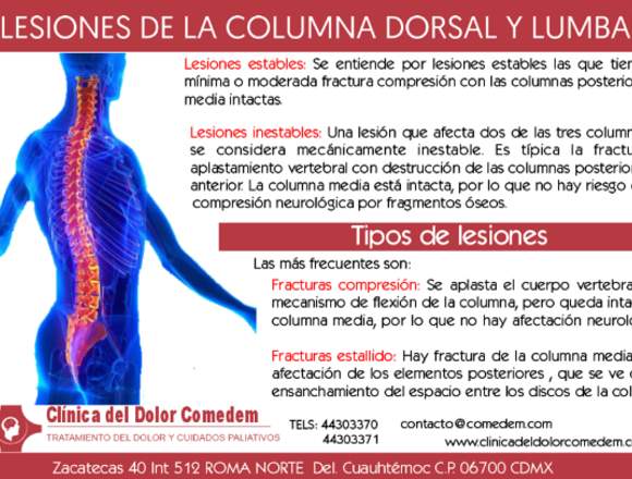 clínica del dolor Lesiones de la columna en Azcapotzalco (Municipio)