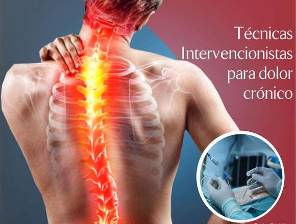 clínica del dolor TÉCNICAS INTERVENCIONISTAS