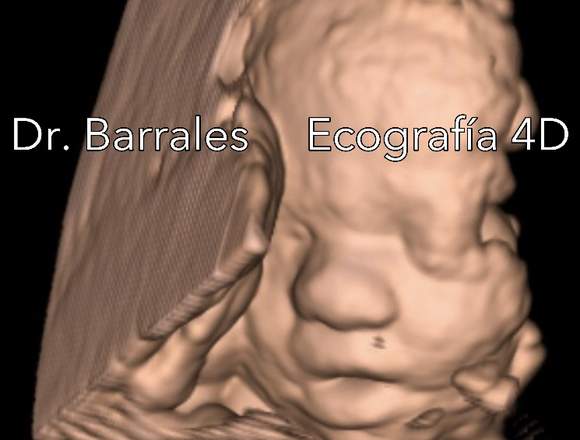 Ecografía Ultrasonido 4D