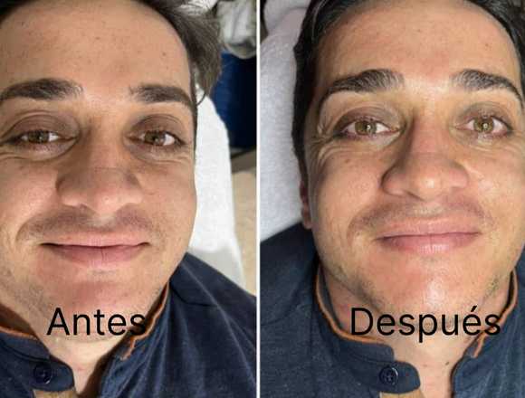 Spa en Bucaramanga | Rejuvenecimiento facial en Bucaramanga (Municipio)