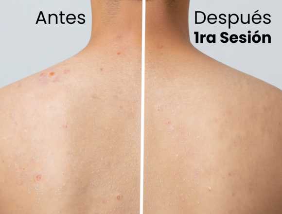 Spa en Bucaramanga | Exfoliación + Masaje Espalda en Bucaramanga (Municipio)